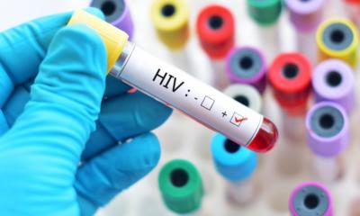 Борбата със СПИН е възпрепятствана от COVID-19