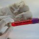 1339 нови случаи на зараза с коронавирус в България за 24 часа